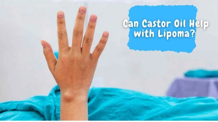 Can Castor Oil Help with Lipoma? Exploring the Natural Remedy