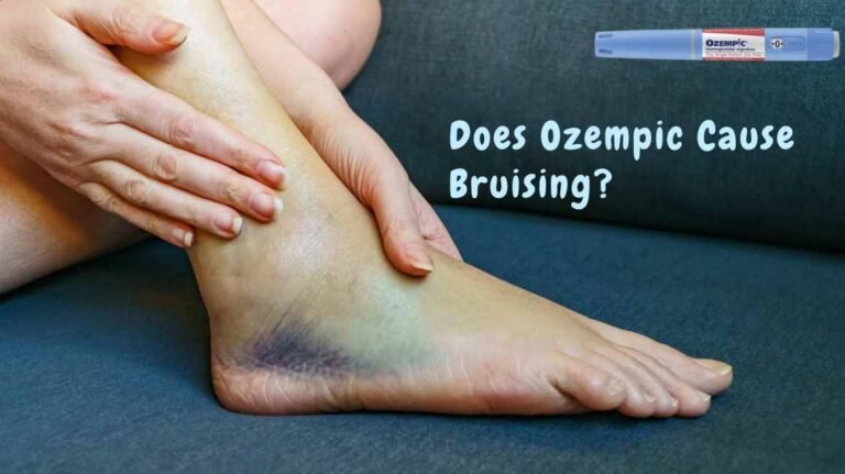 Does Ozempic Cause Bruising? Discover the Truth